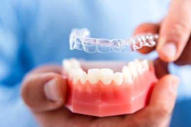 Invisalign: What is day-to-day life like with this new orthodontic treatment?